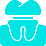 Dental implant illustration in blue